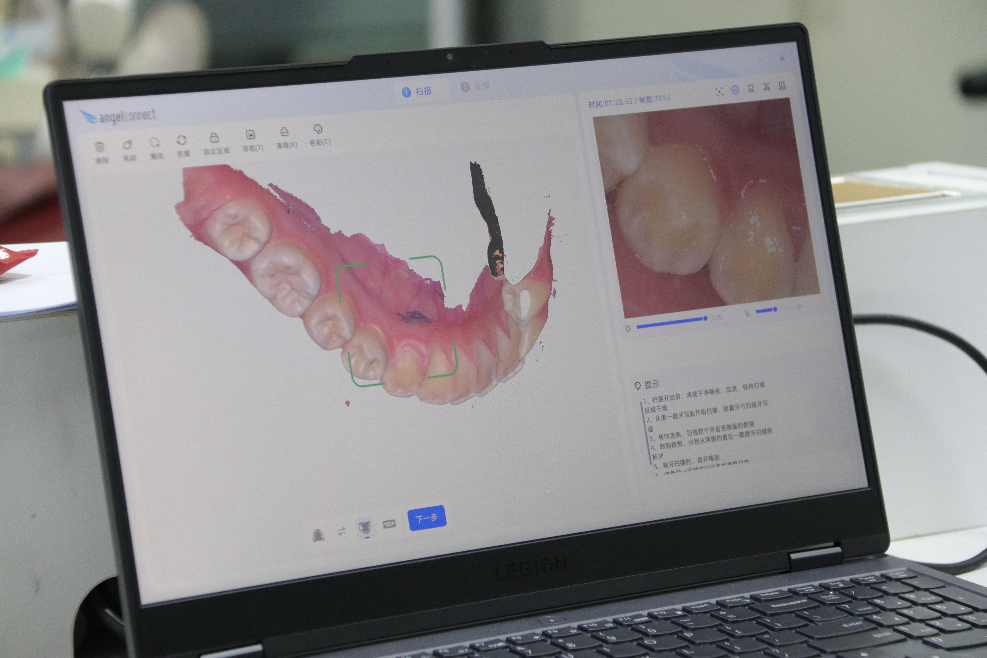 数字化口内扫描可搭建3D口腔成像